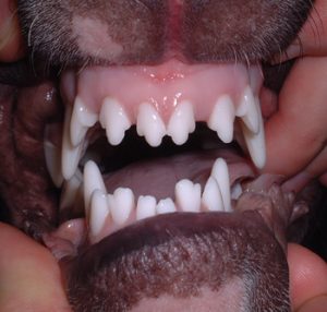 Linguoverted mandibular canines
