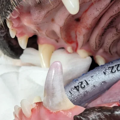 Intrinsically Stained Teeth
