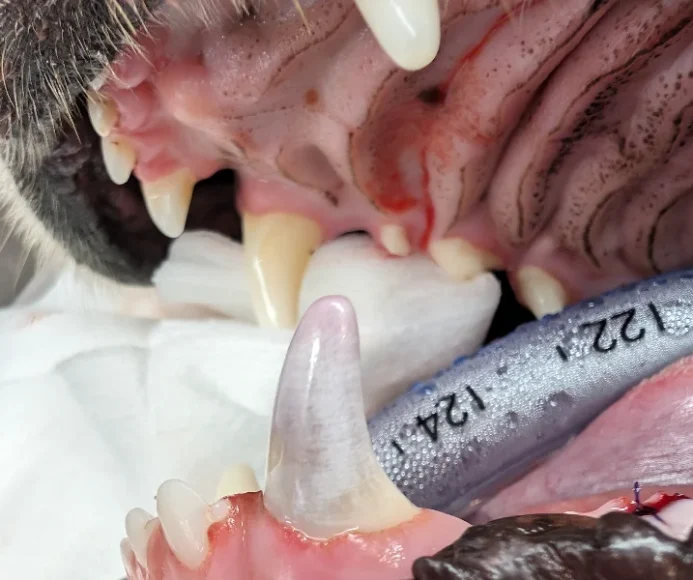 Intrinsically Stained Teeth