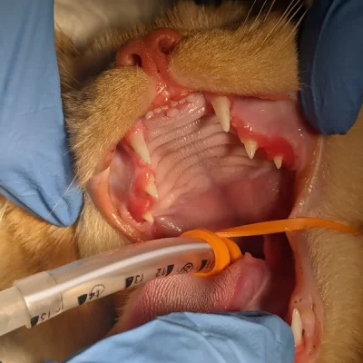 Juvenile Gingivitis and Periodontitis
