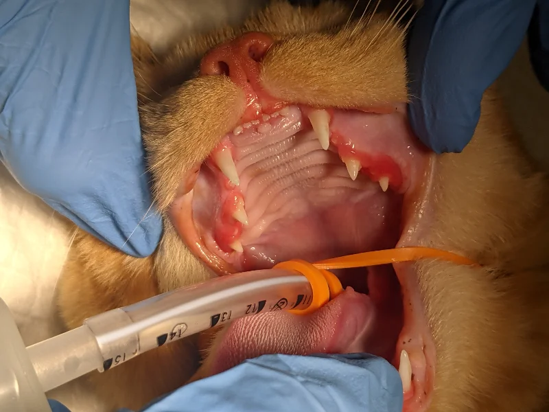 Juvenile Gingivitis and Periodontitis