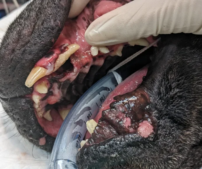 Avulsion of Teeth