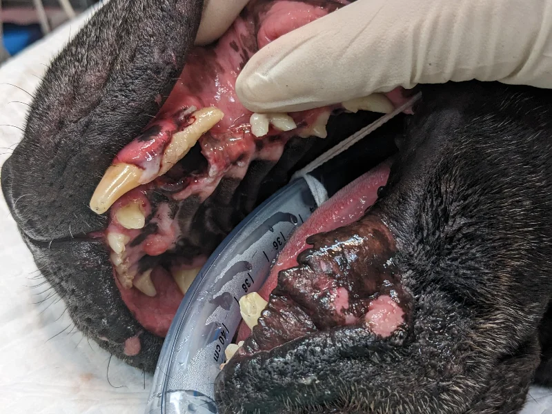 Avulsion of Teeth