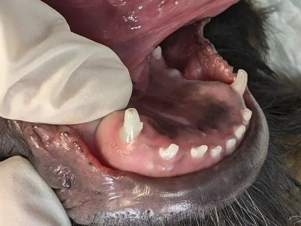 Deciduous Canine Extractions