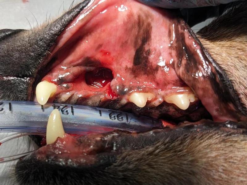 Extractions