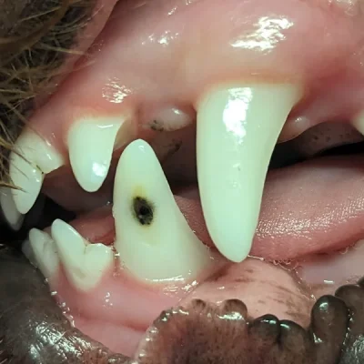 Enamel Hypoplasia
