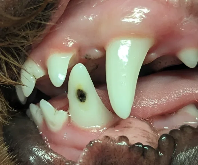 Enamel Hypoplasia