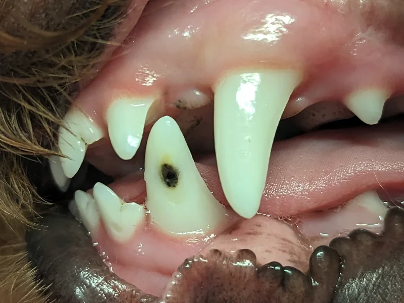 Enamel Hypoplasia