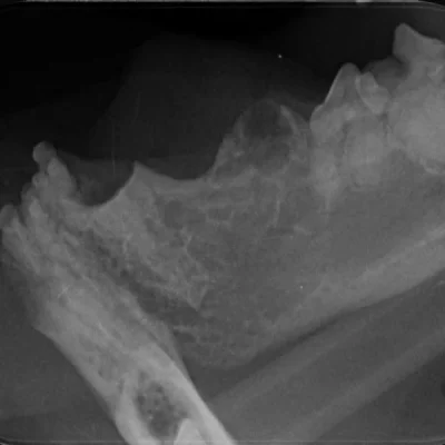 Crown Amputation for Tooth Resorption