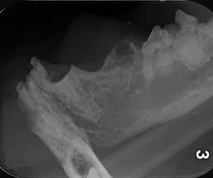 Crown Amputation for Tooth Resorption