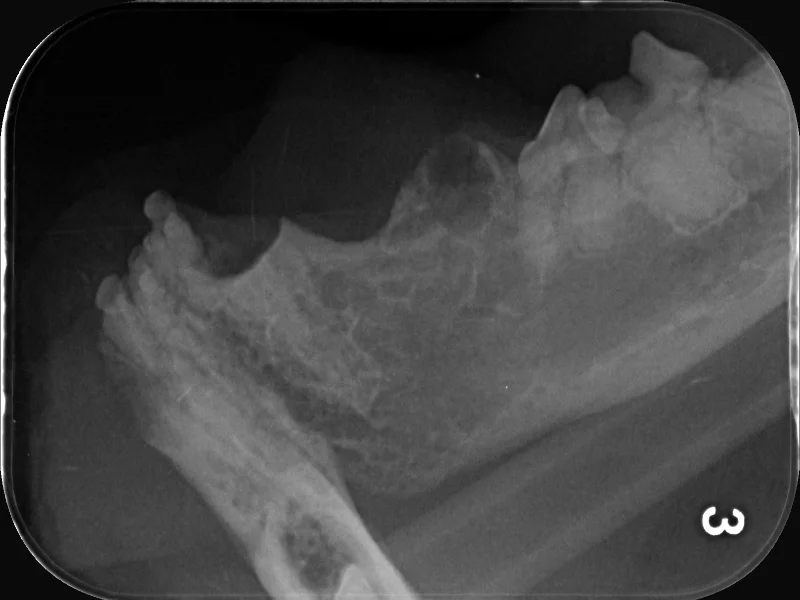 Crown Amputation for Tooth Resorption