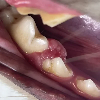 Oral Masses