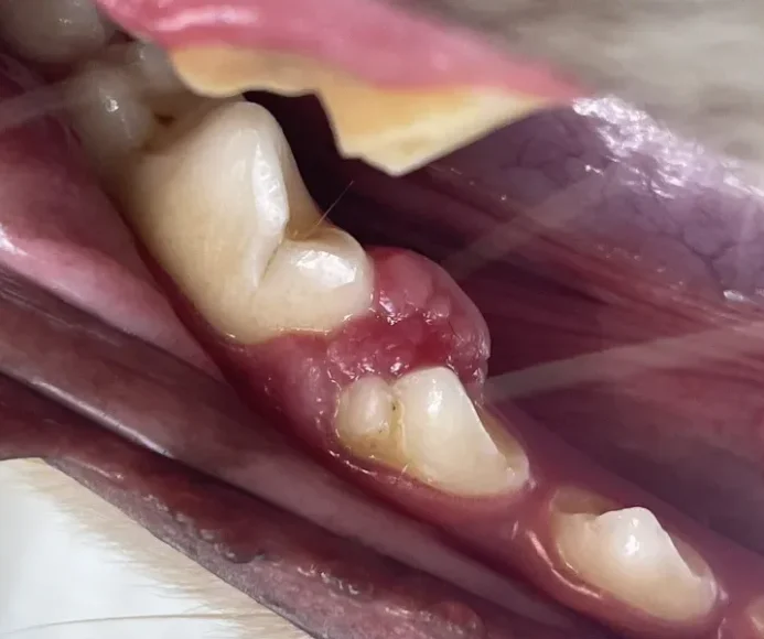 Oral Masses