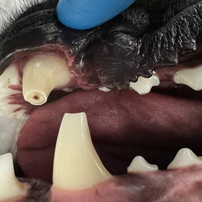 Root Canal Therapy