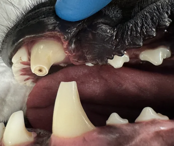 Root Canal Therapy
