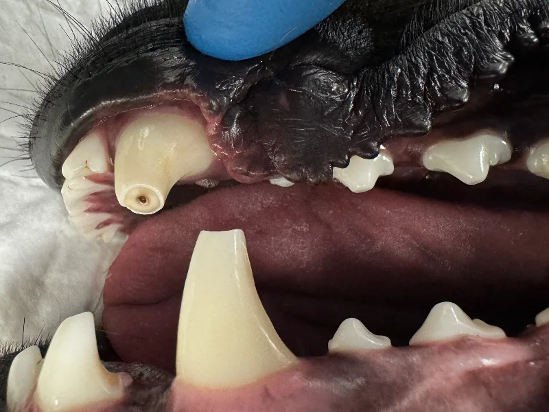 Root Canal Therapy