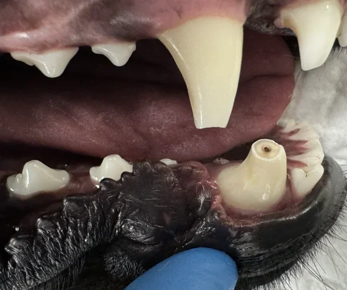 Root Canal Therapy