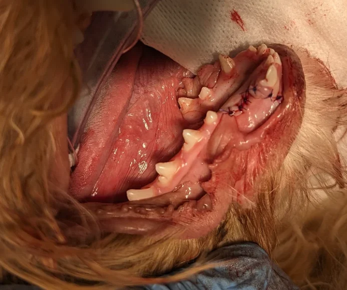 Mandibular Canine Extractions