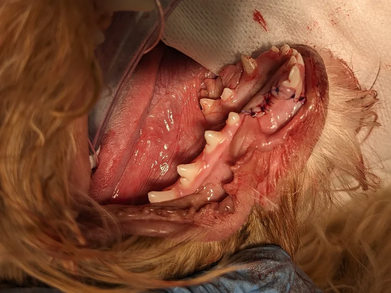 Mandibular Canine Extractions