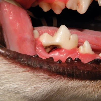 Periodontal Disease Staging