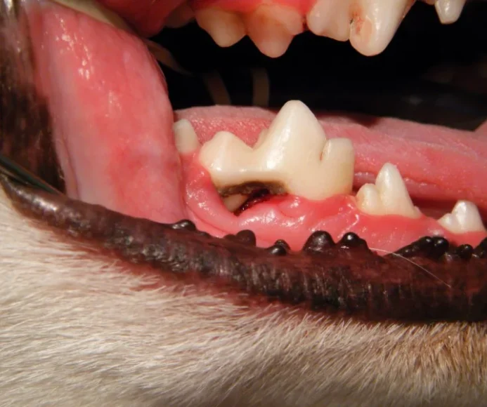 Periodontal Disease Staging
