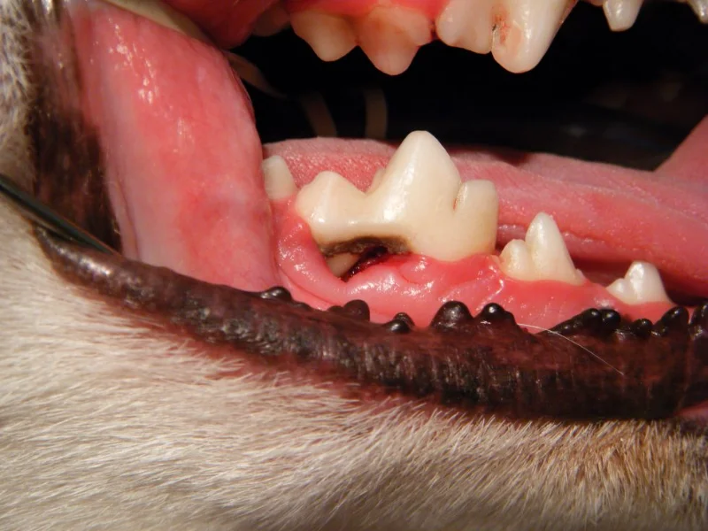 Periodontal Disease
