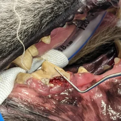 Tooth Resorption