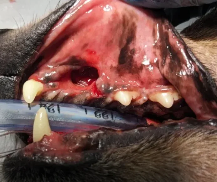 Extractions