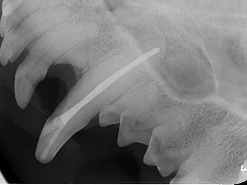 Root Canal Therapy