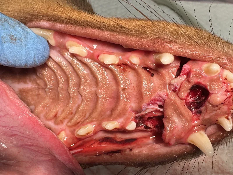 Jaw Fractures