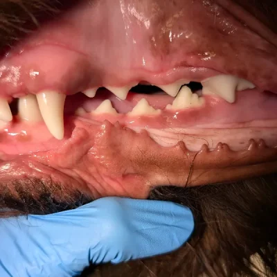 Malocclusion (Misaligned Teeth)