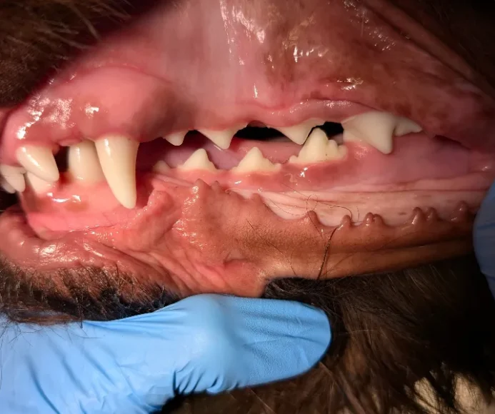 Malocclusion (Misaligned Teeth)