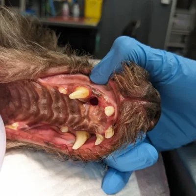 Oronasal Fistula