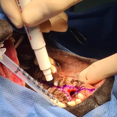 Oral Surgery