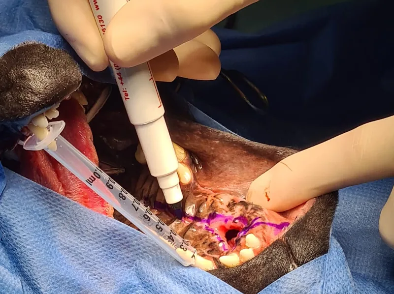 Oral Surgery