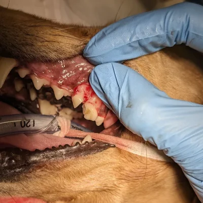Surgical Extractions