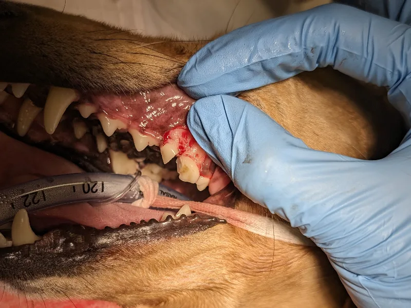 Surgical Extractions