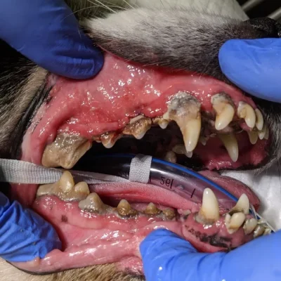 Periodontal Disease (Inflamed Gums)