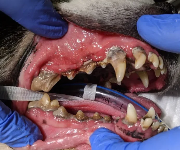 Periodontal Disease (Inflamed Gums)