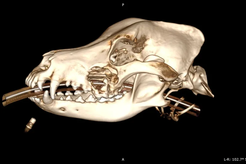AAD - Jaw surgeries and associated conditions jaw ct scan