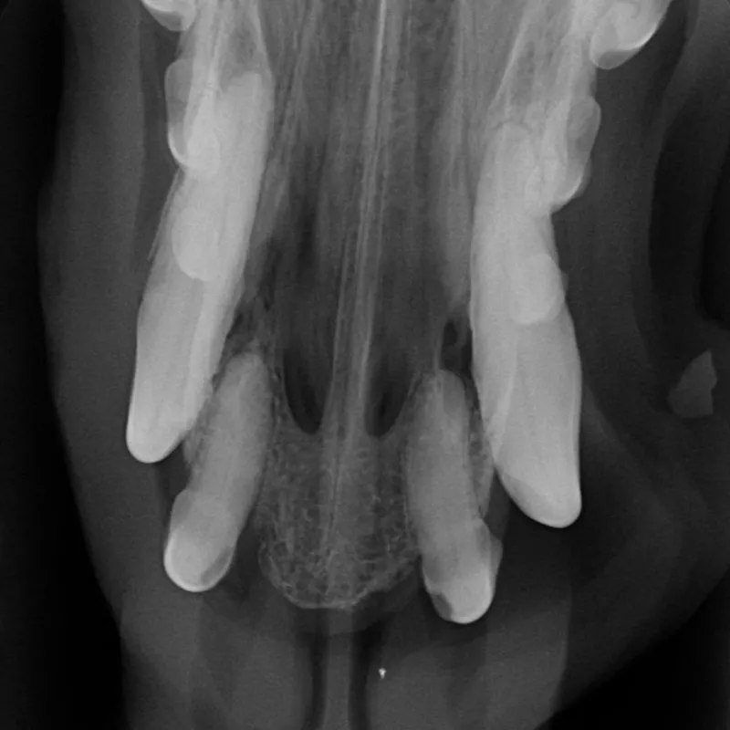 Dental X-ray of the upper front teeth showing bone loss around the central incisors and root crowns with restorations present
