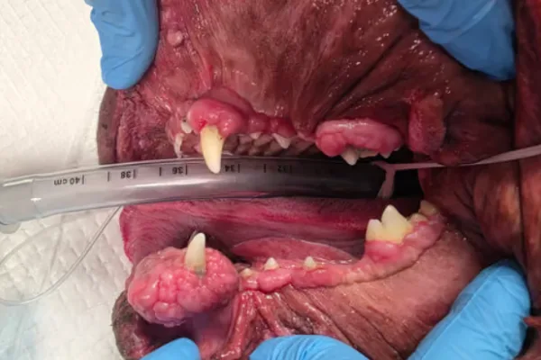 A practical guide to treating gingival enlargement