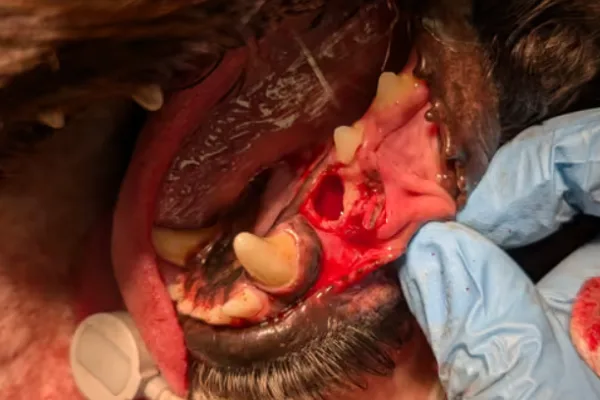 What to do now that you have found an unerupted tooth?