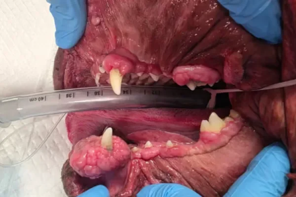 A practical guide to treating gingival enlargement